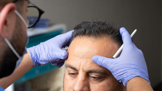 A Comprehensive Guide to Finding the Best Hair Transplant Solution, Surgeon, and Clinic Near You